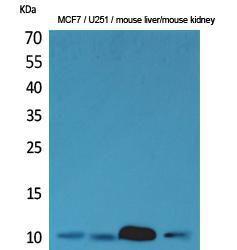 Western blot analysis of MCF7, U25 mouse liver, mouse kidney cells using Anti-DBI Antibody