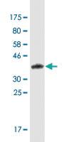 Anti-CRTC1 Mouse Monoclonal Antibody [clone: 8F9]