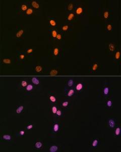 Immunofluorescence analysis of NIH-3T3 cells using Anti-RNA Helicase A Antibody [ARC1033] (A306342) at a dilution of 1:100 (40X lens). DAPI was used to stain the cell nuclei (blue)