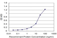 Anti-CD34 Mouse Monoclonal Antibody [clone: 5A6]