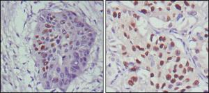 Anti-TP53 Mouse Monoclonal Antibody [clone: 13B597]