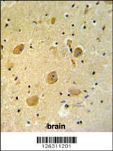 Anti-PARP16 Rabbit Polyclonal Antibody (APC (Allophycocyanin))