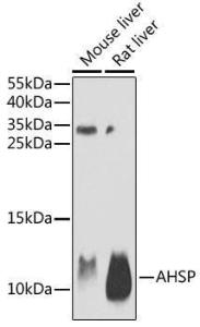 Western blot analysis of extracts of various cell lines, using Anti-Ahsp Antibody (A9881) at 1:1,000 dilution. The secondary antibody was Goat Anti-Rabbit IgG H&L Antibody (HRP) at 1:10,000 dilution.