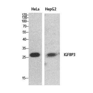 Western blot analysis of HeLa, HepG2 cells using Anti-IGFBP3 Antibody