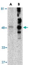 Anti-HAVCR1 Rabbit Polyclonal Antibody