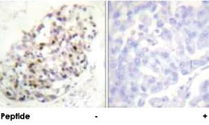 Anti-KIF20A Rabbit Polyclonal Antibody