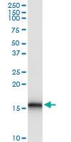 Anti-BST2 Polyclonal Antibody Pair