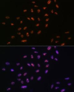 Immunofluorescence analysis of U-2 OS cells using Anti-RNA Helicase A Antibody [ARC1033] (A306342) at a dilution of 1:100 (40X lens). DAPI was used to stain the cell nuclei (blue)