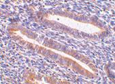 Anti-HAVCR1 Rabbit Polyclonal Antibody