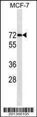 Anti-ESR1 Mouse Monoclonal Antibody [clone: 415CT16.3.2.1]