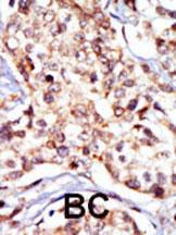 Anti-SRC Rabbit Polyclonal Antibody (AP (Alkaline Phosphatase))