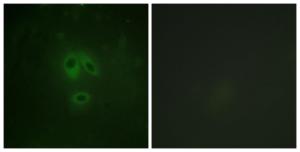 Immunofluorescence analysis of HeLa cells using Anti-n-NOS (phospho Ser852) Antibody. The right hand panel represents a negative control, where the antibody was pre-incubated with the immunising peptide