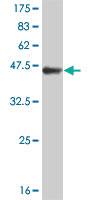 Anti-TIMP2 Mouse Monoclonal Antibody [clone: 5B11]