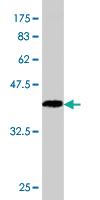 Anti-RBP4 Mouse Monoclonal Antibody [clone: 1A8]