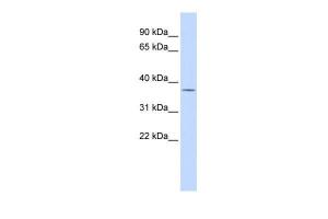 Anti-PARP16 Rabbit Polyclonal Antibody