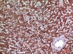 Immunohistochemical analysis of paraffin-embedded human liver using Anti-IGFBP3 Antibody