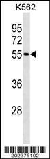 Anti-ESR2 Mouse Monoclonal Antibody [clone: 555CT18.5.5]