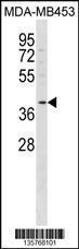 Anti-FFAR2 Rabbit Polyclonal Antibody (FITC (Fluorescein Isothiocyanate))