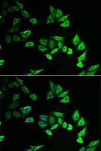 Antibody anti-MYOZ2 100 µl