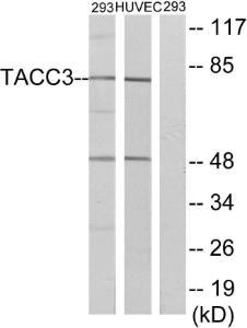 Western blot analysis of lysates from 293 and HUVEC cells using Anti-TACC3 Antibody. The right hand lane represents a negative control, where the antibody is blocked by the immunising peptide