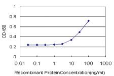 Anti-OPRL1 Mouse Monoclonal Antibody [clone: 2A11]