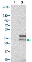 Anti-CD99L2 Rabbit Polyclonal Antibody