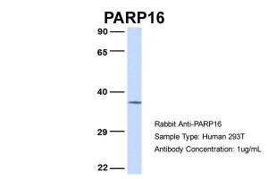 Anti-PARP16 Rabbit Polyclonal Antibody