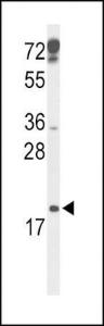 Anti-p19 Rabbit Polyclonal Antibody (FITC (Fluorescein Isothiocyanate))