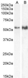 Anti-TFEB Antibody (A83834) (0.5µg/ml) staining of HeLa (A) and (0.3µg/ml) Jurkat (B) cell lysate (35µg protein in RIPA buffer). Detected by chemiluminescence.