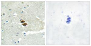 Immunohistochemical analysis of paraffin-embedded human brain using Anti-n-NOS (phospho Ser852) Antibody. The right hand panel represents a negative control, where the antibody was pre-incubated with the immunising peptide