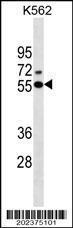 Anti-ESR2 Mouse Monoclonal Antibody [clone: 555CT18.5.5]