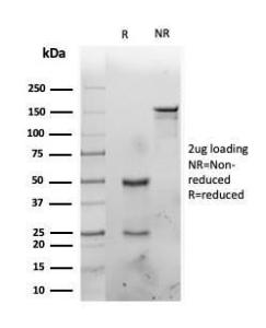 SDS-PAGE analysis of Anti-IL-1 alpha Antibody [IL1A/3981] under non-reduced and reduced conditions; showing intact IgG and intact heavy and light chains, respectively. SDS-PAGE analysis confirms the integrity and purity of the antibody