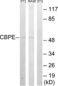 Western blot analysis of lysates from RAW264.7 and NIH/3T3 cells using Anti-CPE Antibody. The right hand lane represents a negative control, where the antibody is blocked by the immunising peptide