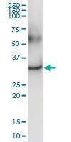 Anti-DECR2 Polyclonal Antibody Pair