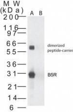 Anti-Smallpox B5R Rabbit Polyclonal Antibody