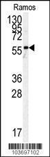 Anti-PKM Rabbit Polyclonal Antibody (Biotin)