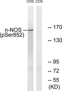 Western blot analysis of lysates from A549 cells using Anti-n-NOS (phospho Ser852) Antibody. The right hand lane represents a negative control, where the antibody is blocked by the immunising peptide