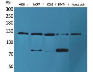 Anti-NCAM Rabbit Polyclonal Antibody