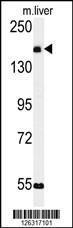 Anti-CCDC180 Rabbit Polyclonal Antibody (PE (Phycoerythrin))