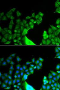 Immunofluorescence analysis of HeLa cells using Anti-Bcl G/BCL2L14 Antibody (A9886) DAPI was used to stain the cell nuclei (blue)