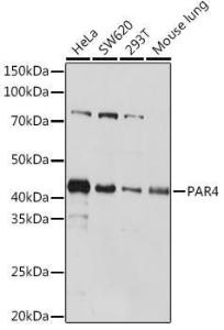 Western blot analysis of extracts of various cell lines, using Anti-PAR4 Antibody [ARC1980] (A309260) at 1:1,000 dilution. The secondary antibody was Goat Anti-Rabbit IgG H&L Antibody (HRP) at 1:10,000 dilution.