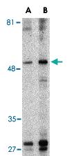 Anti-TIMD4 Rabbit Polyclonal Antibody