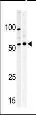 Anti-MYT1 Rabbit Polyclonal Antibody (AP (Alkaline Phosphatase))