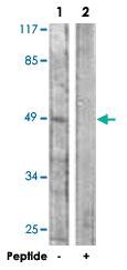 Anti-KCNJ16 Rabbit Polyclonal Antibody