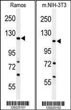 Anti-ARHGAP30 Rabbit Polyclonal Antibody (Biotin)