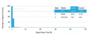 Analysis of protein array containing more than 19,000 full-length human proteins using Anti-IL-1 alpha Antibody [IL1A/3981]