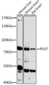 Western blot analysis of extracts of various cell lines, using Anti-PUS7 Antibody (A306343) at 1:1,000 dilution. The secondary antibody was Goat Anti-Rabbit IgG H&L Antibody (HRP) at 1:10,000 dilution.