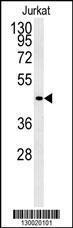 Anti-FFAR3 Rabbit Polyclonal Antibody (FITC (Fluorescein Isothiocyanate))