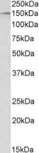 Anti-HDAC6 Antibody (A83838) (1 µg/ml) staining of HeLa nuclear lysate (35 µg protein in RIPA buffer). Primary incubation was 1 hour. Detected by chemiluminescence