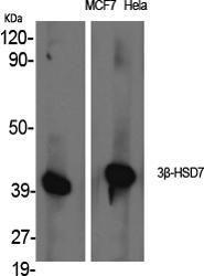 Western blot analysis of various cells using Anti-HSD3B7 Antibody